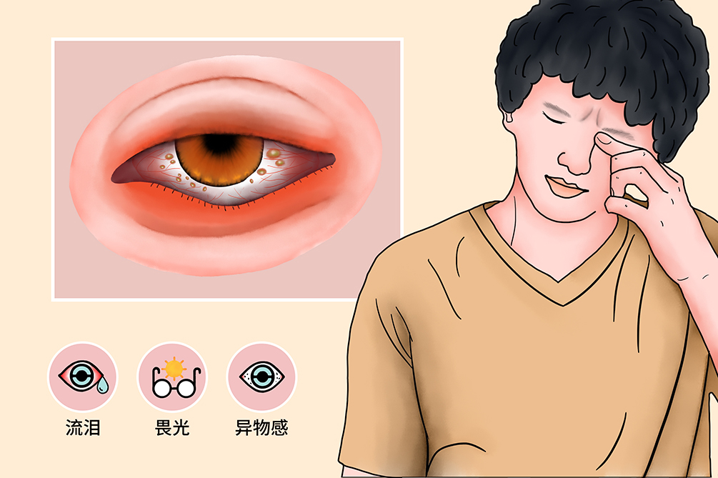 春季我们应该怎么保护眼睛呢？